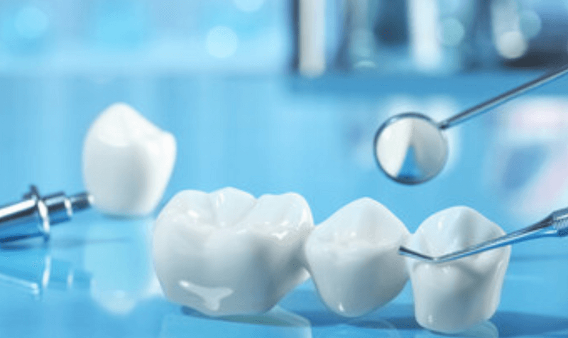 What to Do When Your Dental Crowns Break: A Guide | Lakeshore Dental Studio