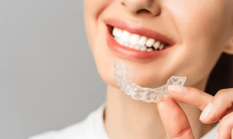 Clear Aligners: Perfect Solution For Straight Teeth