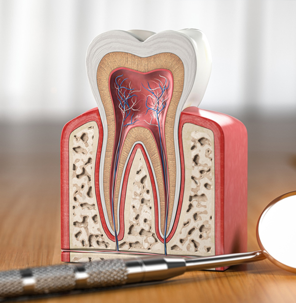 root canals in chicago