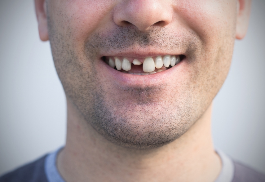 the importance of immediate treatment for a cracked tooth