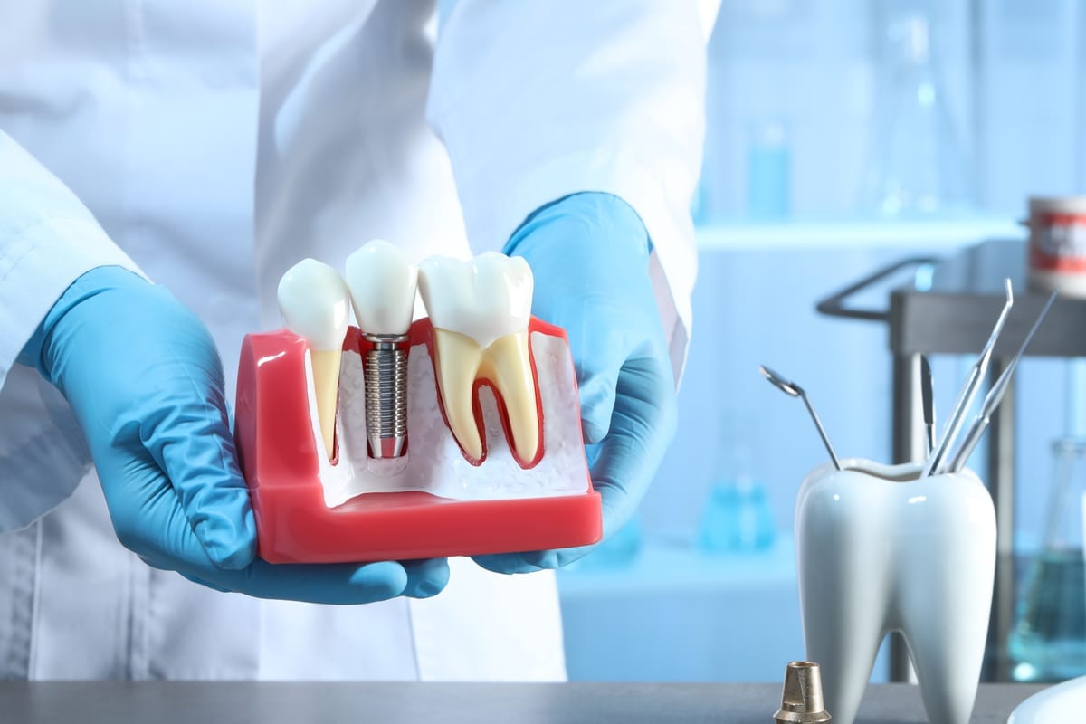 Dental Implants in Lincoln Square