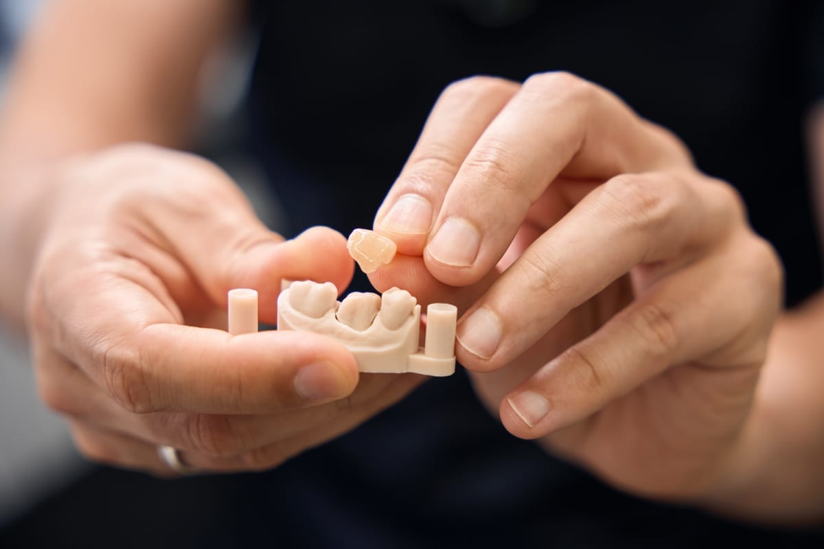 Dental Crowns in Chicago